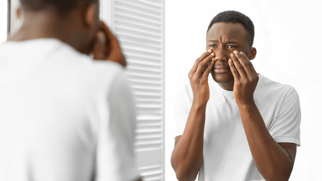 How to Treat Itchy Eyes after Wearing Contact Lenses